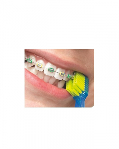 Ортодонтическая щетка CS5460 ortho в целлофане
