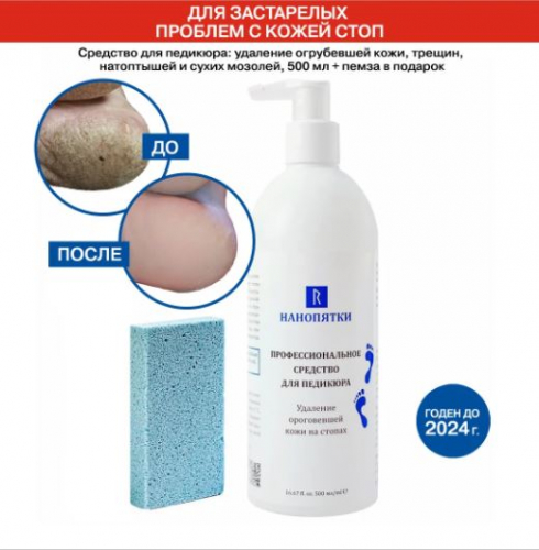 НАНОПЯТКИ / Кератолитик - для застарелых проблем с кожей стоп - для удаления трещин, натоптышей + пемза