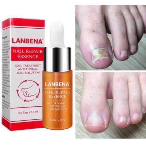 Противогрибковые средство для ногтей Lanbena Nail Repair Essence