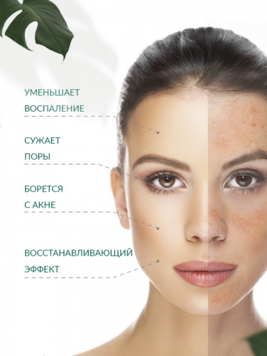 Some by mi / Крем для проблемной и чувствительной кожи с AHA/BHA/PHA 30 Days Miracle Cream, 60мл.