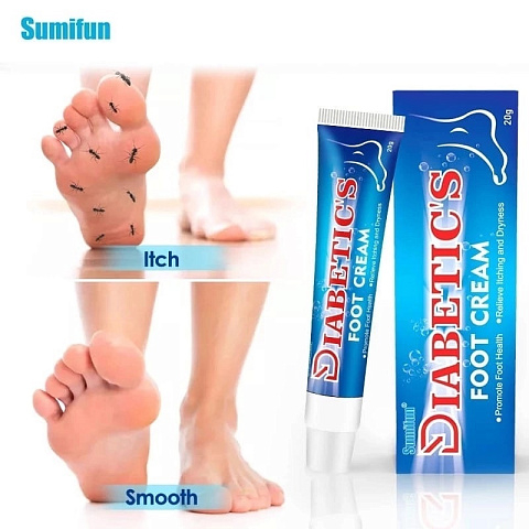 Крем для лечения диабетической стопы Sumifun, 20 гр Diabetic`s foot cream