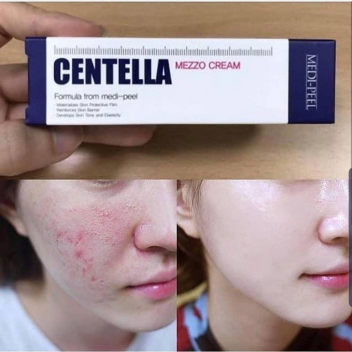 Крем для лица успокаивающий с центеллой для чувствительной кожи MEDI-PEEL Centella Mezzo Cream