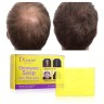 DISAAR  Твердый Шампунь ANTI - HAIR LOSS & Hair Growth + GINGER Против выпадения волос ИМБИРЬ  100г  (DS-5236)