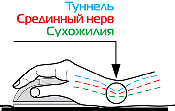 Компьютерный браслет для детей и людей с узким запястьем. Защита запястья и комфорт при работе с ПК