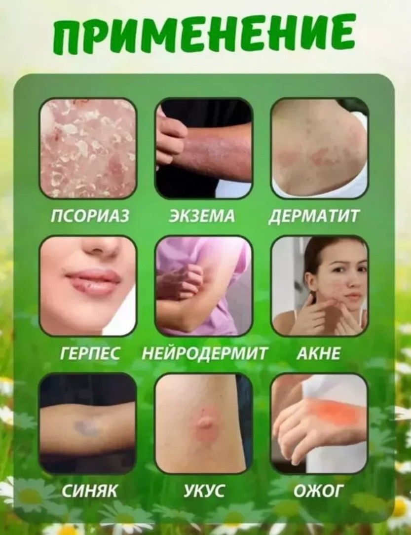 Мазь широкого действия FULE WANG