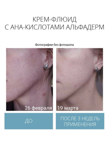 Обновляющий флюид Альфадерм, фл. 30 мл