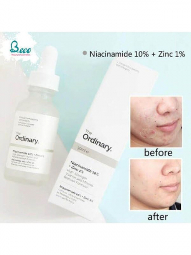 The Ordinary / Сыворотка с витамином B3 и цинком – Niacinamide 10% + Zinc 1%. 30 мл.