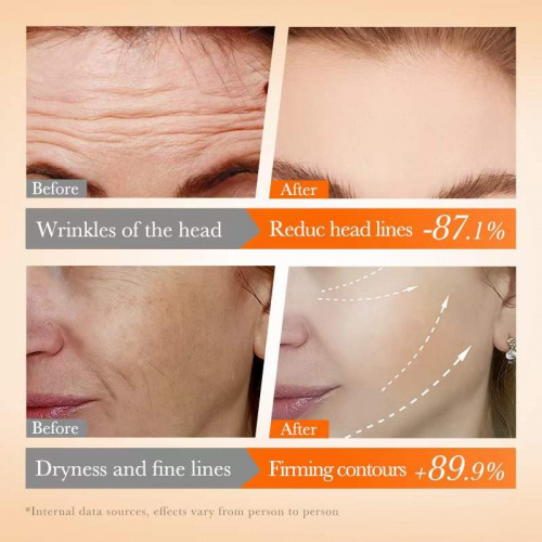 SADOER Подарочный набор водорастворимых патчей для лица COLLAGEN MULTI-PEPTIDE PATCH