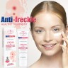 AICHUN BEAUTY Крем для лица ANTI-FRECKLE против Веснушек и Пигментных пятен 20г (AC-2002)