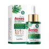 SADOER Эссенция для лица ACNES Oil Control Чайное Дерево 30мл (SD-42446)