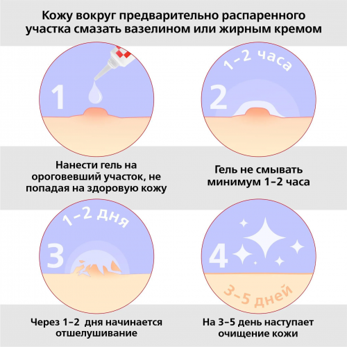 Антипапиллом гель