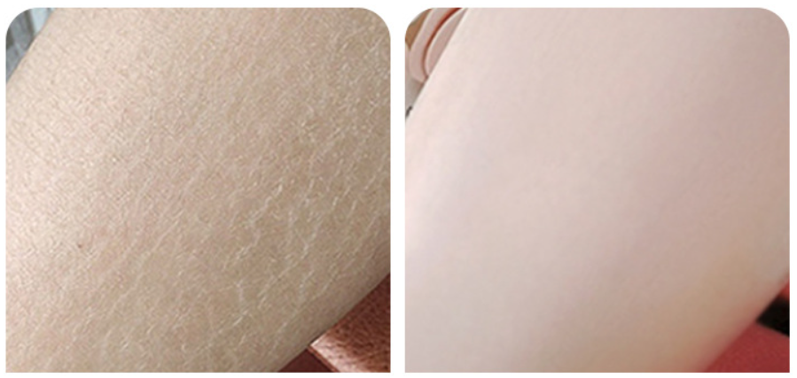 Крем увлажняющий с мочевиной и витамином Е Bioaqua Vitamin E Urea Cream, 170 гр.