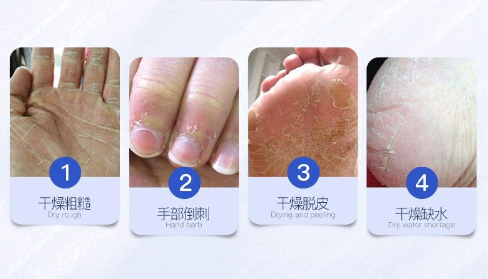 Восстанавливающий крем глубокого действия для рук и ног глубокого действия от трещин на коже Images, 58 гр.