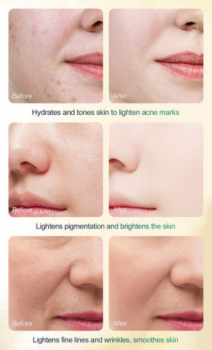 Пилинг-сыворотка для лица с яблочной и цитрусовой кислотами MOOYAM TCA Peel Serum, 30 мл.