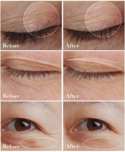 Крем для век антивозрастной с ретинолом Luofmiss Retinol, 30 гр.