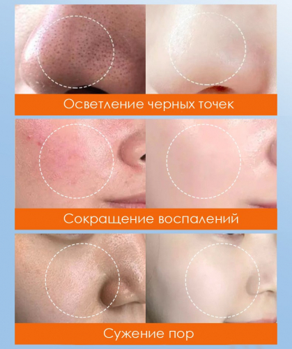 Пузырьковая маска для лица с экстрактом моркови Sadoer, 85 гр.