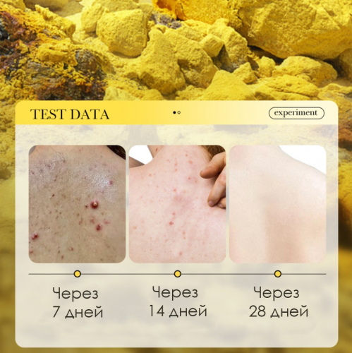 Серное мыло антибактериальное для проблемной кожи Sadoer Sulfur Soap, 125 гр.