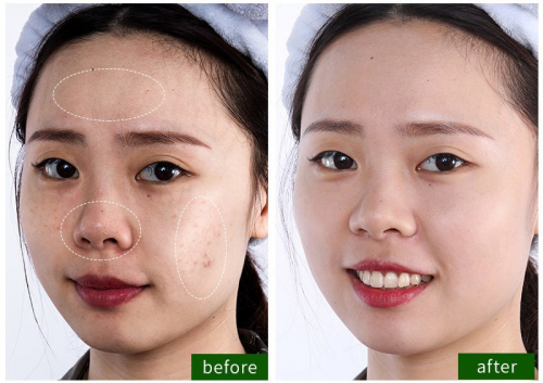 Кислородная пузырьковая маска для лица Bioaqua Carbonated Bubble Clay Mask, 100гр.