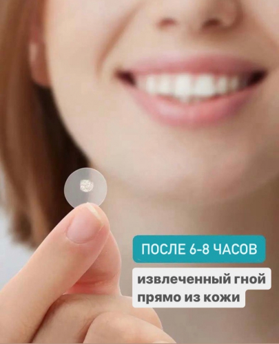 Гидроколлоидные пластыри от прыщей и акне, 40 шт