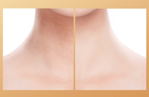 Коллагеновый патч для шеи JomTam Hexapeptide Collagen Neck Mask, 1 штука 30 гр.