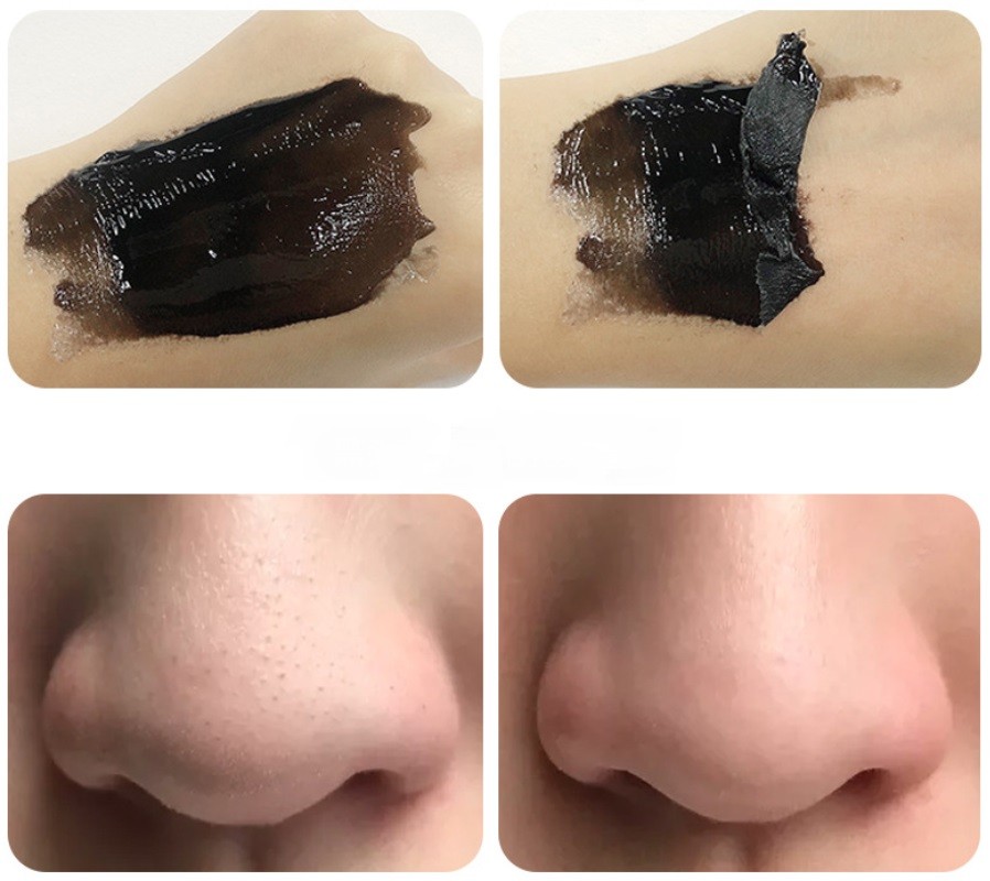 Маска-пленка с салициловой кислотой для глубокого очищения пор Zoo-Son Salicylic Acid Blackhead, 40 гр.