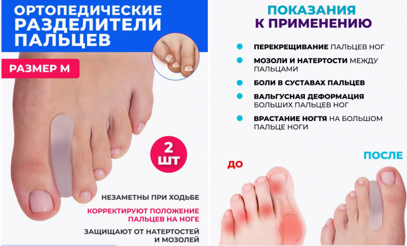 Разделители для пальцев ног вальгусный корректор, М
