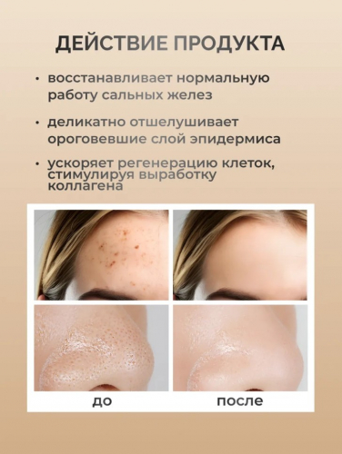 SADOER Отшелушивающий тонер с гликолевой кислотой Glycolic Acid 7% Toner, 230 мл