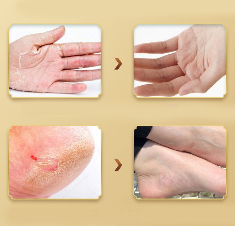 Смягчающий бальзам для сухих участков с лошадиным жиром Jintaikang, 80 гр.