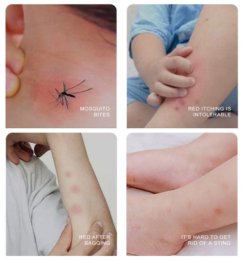 Бальзам от укусов насекомых в стике ZOO-SON Refreshing comfrey oinment, 7,4 гр.