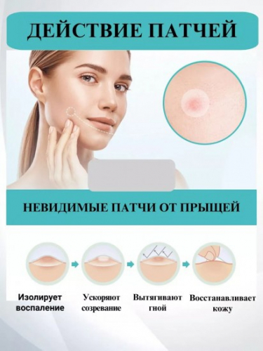 Гидроколлоидные пластыри от прыщей и акне, 40 шт