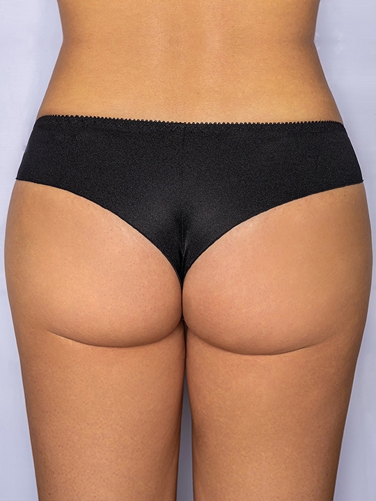 Трусы Alessandra Albina_L ЧЗ бразильяна Albina L 353алТмчз