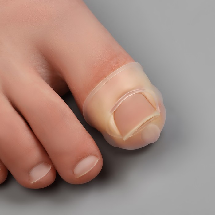 Защитные чехлы для коррекции вросших ногтей, пара, 2.8×2 см, бежевые